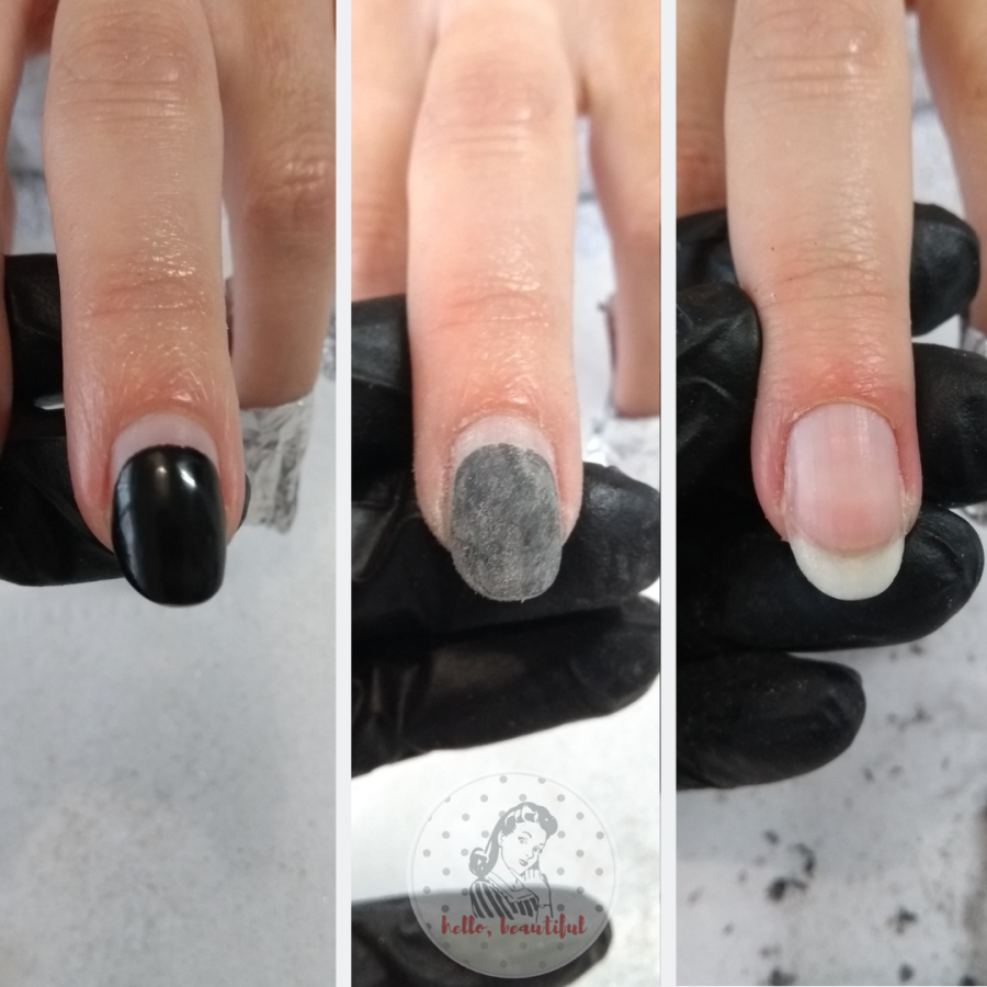 natural nails removal